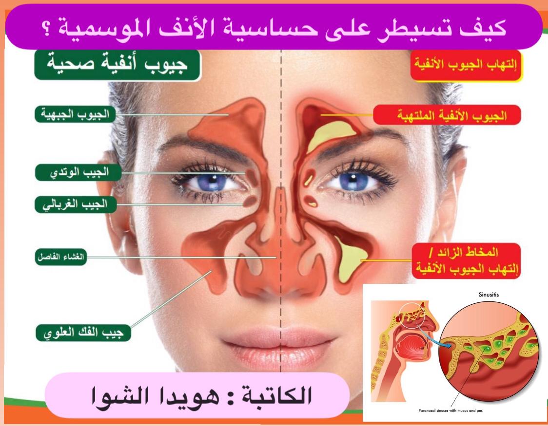 ( كيف تسيطر على حساسية الأتف الموسمية ؟)