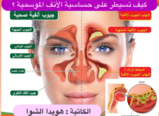 ( كيف تسيطر على حساسية الأنف الموسمية ؟)