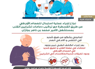 نجاح إجراء عملية استبدال للصمام الأورطي عن طريق القسطرة مع تركيب دعامات لشرايين القلب بمستشفى الامير محمد بن ناصر بجازان
